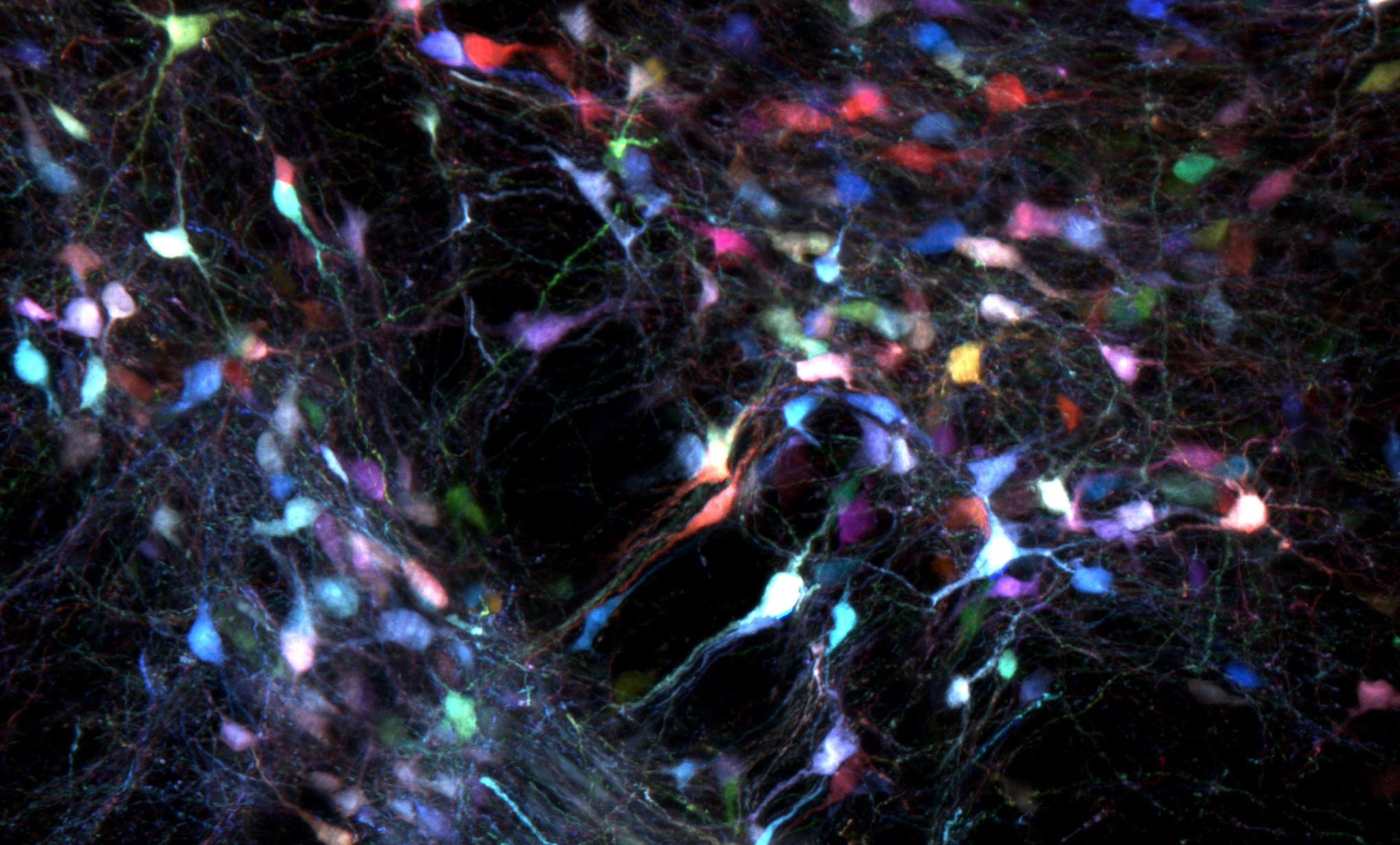 We aim to bridge the gap between what is currently feasible in neuromodulation and what is needed to meaningfully improve the lives of those with neuropathologies. We have used protein engineering principles to noninvasively, effectively, and specifically deliver effector genomes to nervous tissues and associated cell types. We have made advances in the creation of systemic viruses that cross the BBB, which open up the potential for noninvasive modulation of targets deep in the brain. In addition, we have used our gene delivery and optogenetic tools to modulate the peripheral nervous system in a mouse model of PD, demonstrating the potential utility of neuromodulation beyond the brain for the treatment of brain disorders.
